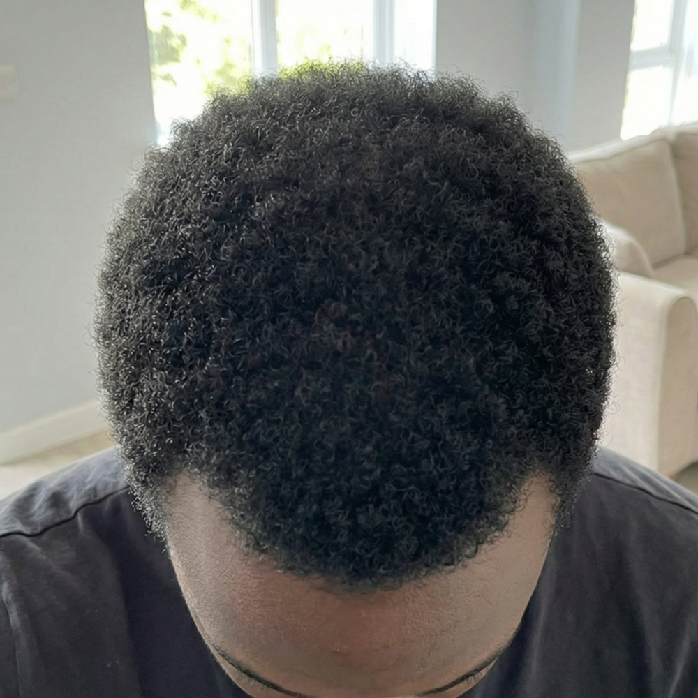 Micro-infusion : efficace sur tous les types de cheveux ?
