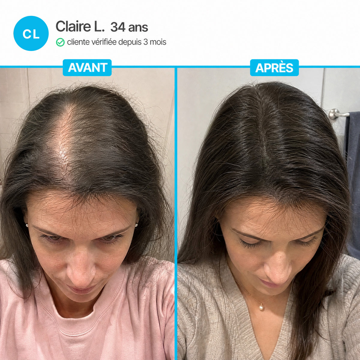 Cure Capillaire Densifiante - Denselia Active™