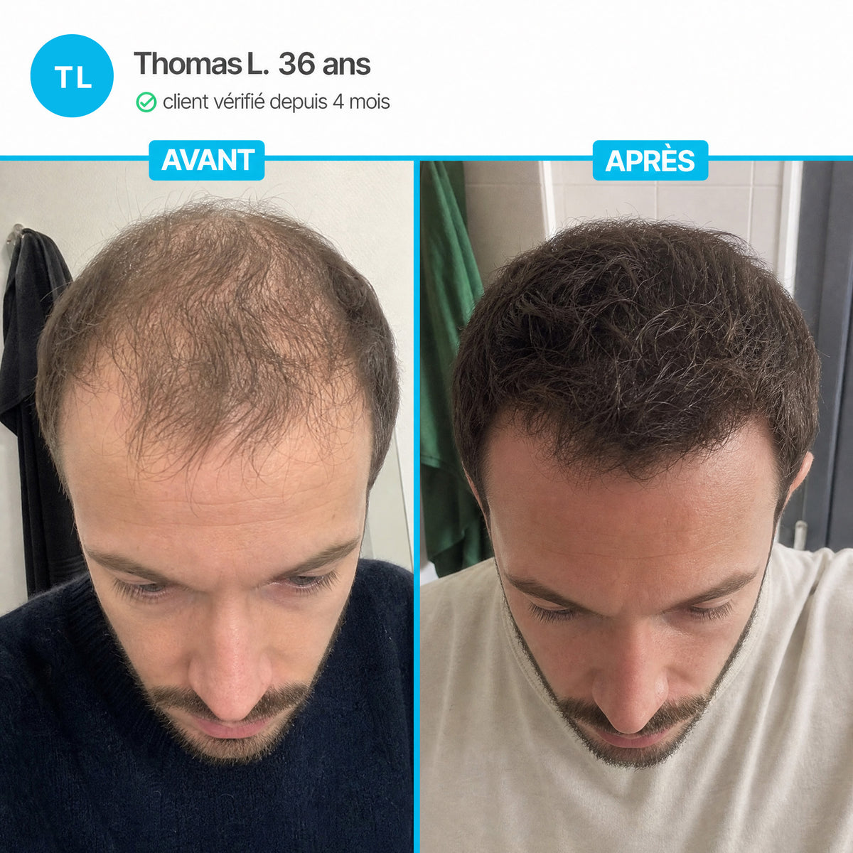 Cure Capillaire Densifiante - Denselia Active™