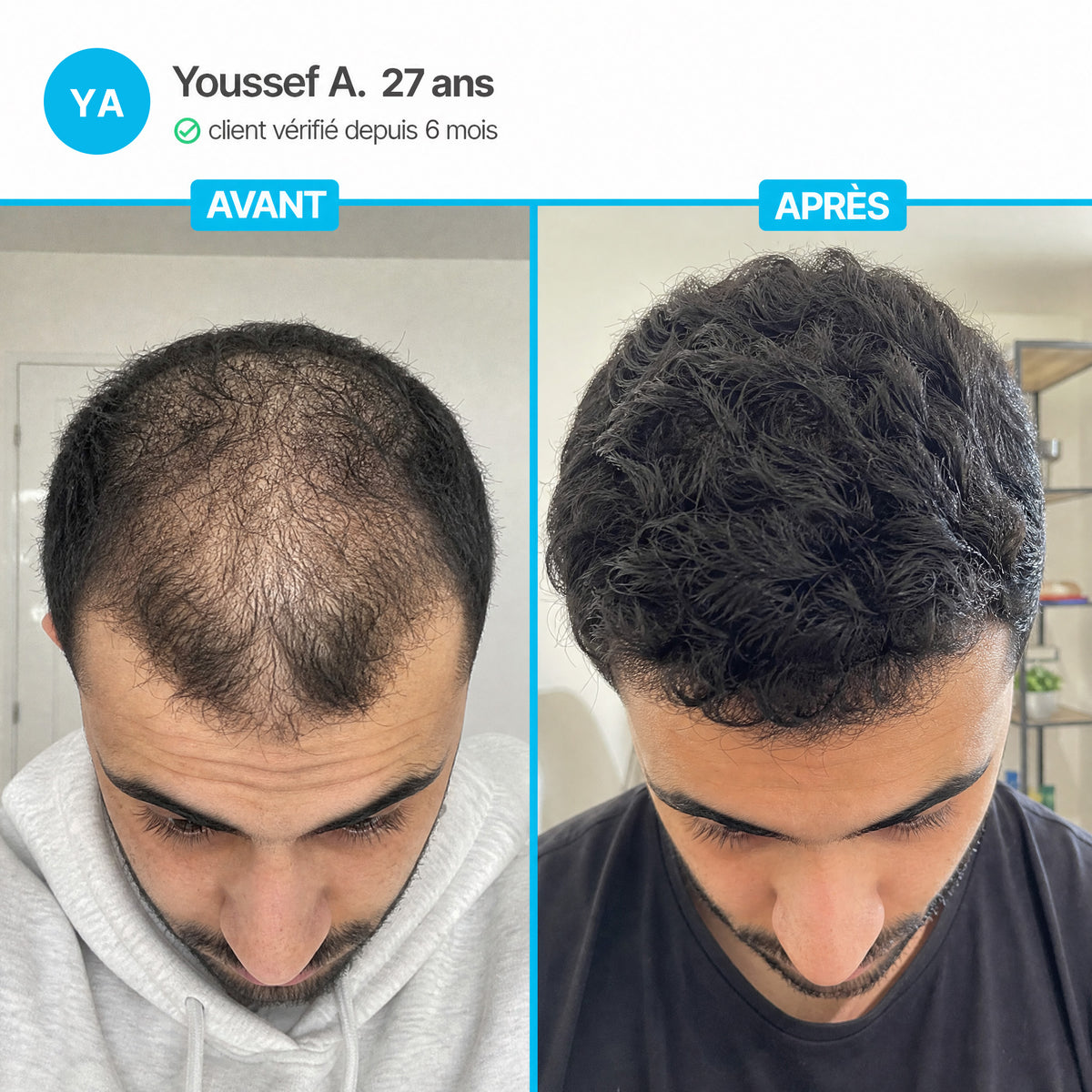 Cure Capillaire Densifiante - Denselia Active™